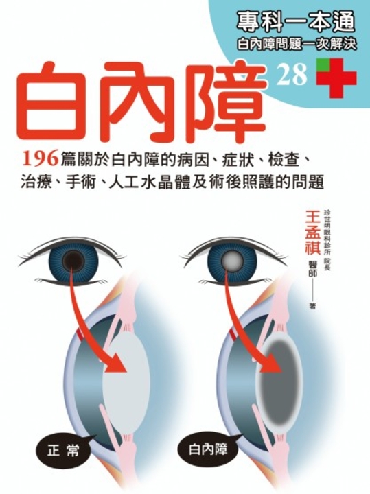 白內障 (電子書)