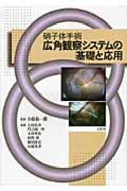 硝子体手術広角観察システムの基礎と応用| 誠品線上