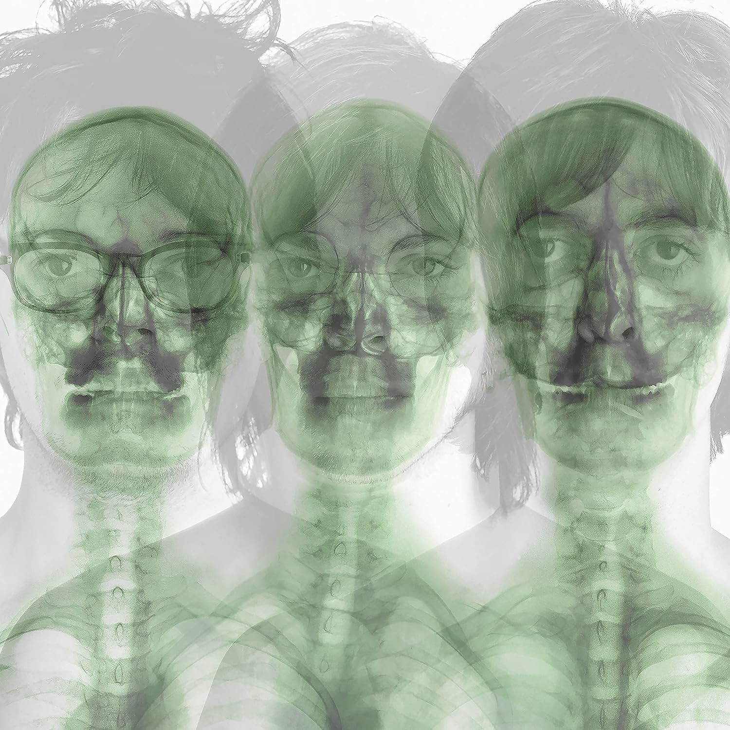 Supergrass (2CD)